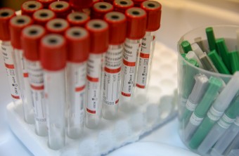 Оперштаб: Более 500 человек в Приморье заболели COVID-19 за сутки